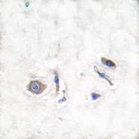 19 - Anti-NRAS/HRAS/KRAS Antibody AP51400