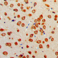 19 - Anti-Netrin 1 Antibody AP51402