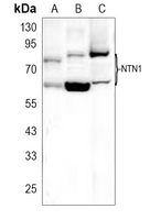 1 - Anti-Netrin 1 Antibody AP51402