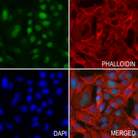 3 - Anti-NUP160 Antibody AP51403