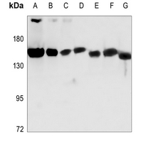 1 - Anti-NUP160 Antibody AP51403