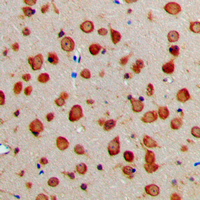 19 - Anti-NXPH1 Antibody AP51406