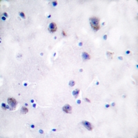 19 - Anti-Mu Opioid Receptor (Phospho-S375) Antibody AP51408