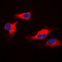 3 - Anti-ORAOV1 Antibody AP51409