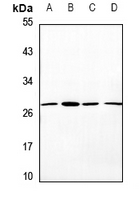1 - Anti-OTUB2 Antibody AP51410
