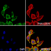 3 - Anti-PALLD Antibody AP51412
