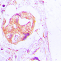 19 - Anti-PALLD Antibody AP51412