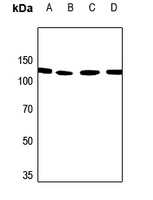 1 - Anti-PALLD Antibody AP51412