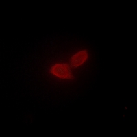 3 - Anti-PARD3 Antibody AP51413