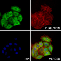 3 - Anti-PARP1 Antibody AP51414