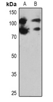 1 - Anti-PARP1 Antibody AP51414