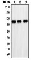 1 - Anti-Cleaved PARP1 Antibody AP51415