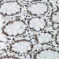 19 - Anti-PAX2 Antibody AP51416