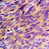 19 - Anti-PDE4B/C/D Antibody AP51417