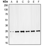 1 - Anti-PDGFB Antibody AP51419
