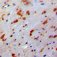 19 - Anti-PDRG1 Antibody AP51421
