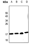 1 - Anti-PDRG1 Antibody AP51421