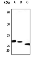 1 - Anti-PEX11B Antibody AP51422