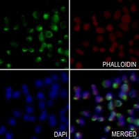 3 - Anti-PEX14 Antibody AP51423