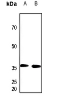 1 - Anti-PEX7 Antibody AP51424
