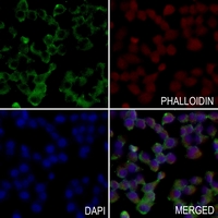 3 - Anti-PFKL Antibody AP51425