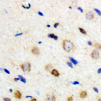 19 - Anti-PFKL Antibody AP51425