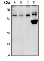 1 - Anti-PFKL Antibody AP51425