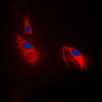 3 - Anti-PFKP Antibody AP51426