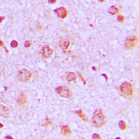 19 - Anti-PFKP Antibody AP51426