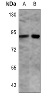 1 - Anti-PFKP Antibody AP51426