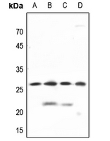 1 - Anti-PGRMC2 Antibody AP51427