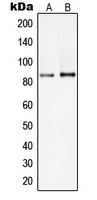 1 - Anti-PI3K p85 beta Antibody AP51428