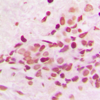 19 - Anti-PKNOX2 Antibody AP51430