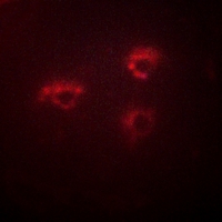 3 - Anti-PMEPA1 Antibody AP51431