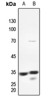 1 - Anti-PMEPA1 Antibody AP51431