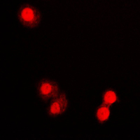 3 - Anti-PML Antibody AP51432