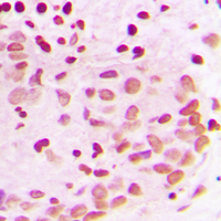 19 - Anti-PML Antibody AP51432