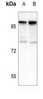 1 - Anti-PML Antibody AP51432