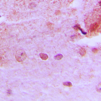 19 - Anti-PMS1 Antibody AP51433