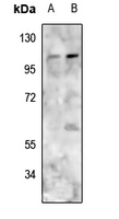1 - Anti-PMS1 Antibody AP51433