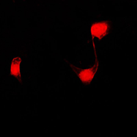 3 - Anti-PPHLN1 Antibody AP51442