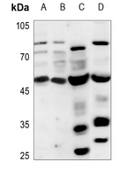 1 - Anti-PPHLN1 Antibody AP51442