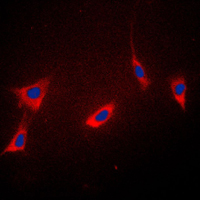 3 - Anti-Cyclophilin F Antibody AP51443