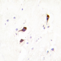 19 - Anti-Cyclophilin F Antibody AP51443