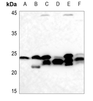 1 - Anti-Cyclophilin F Antibody AP51443