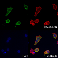 3 - Anti-PPP1R14D Antibody AP51444