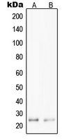 1 - Anti-PPP1R14D Antibody AP51444