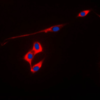 3 - Anti-Peroxiredoxin 3 Antibody AP51445