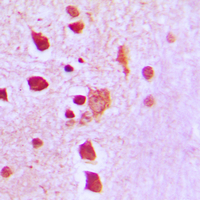 19 - Anti-Peroxiredoxin 3 Antibody AP51445