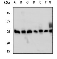 1 - Anti-Peroxiredoxin 3 Antibody AP51445